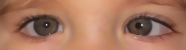 Test photo, true class Esotropia